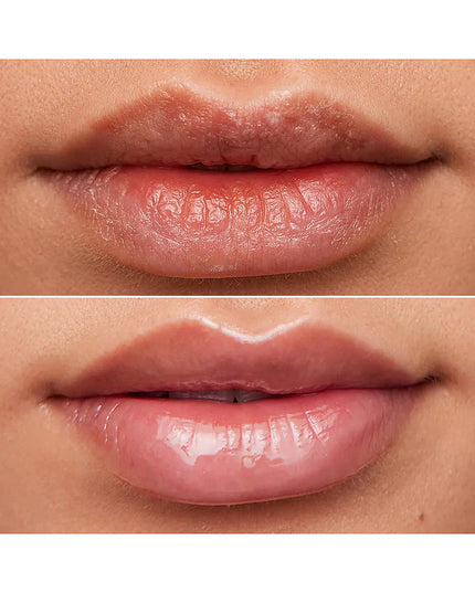 Clear Lip Rehab Serum Oil
