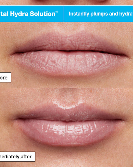 Pre-Order Lip Value Set